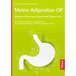 Meine Adipositas-OP. Magenverkleinerung, Magenband, Bypass & Co