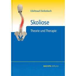 Skoliose