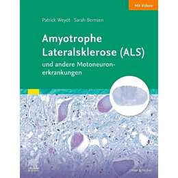 Amyotrophe Lateralsklerose (ALS) und andere Motoneuronerkrankungen