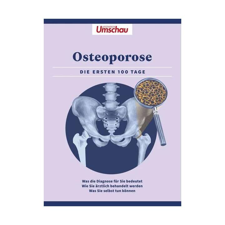 Apotheken Umschau: Osteoporose